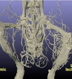 Quantification of Three Dimensional Vascular Network